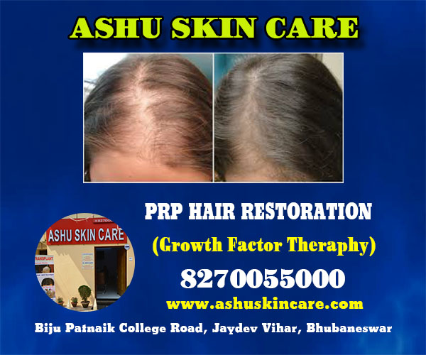 best hair restoration clinic in bhubaneswar near sum hospital - ashu skin care